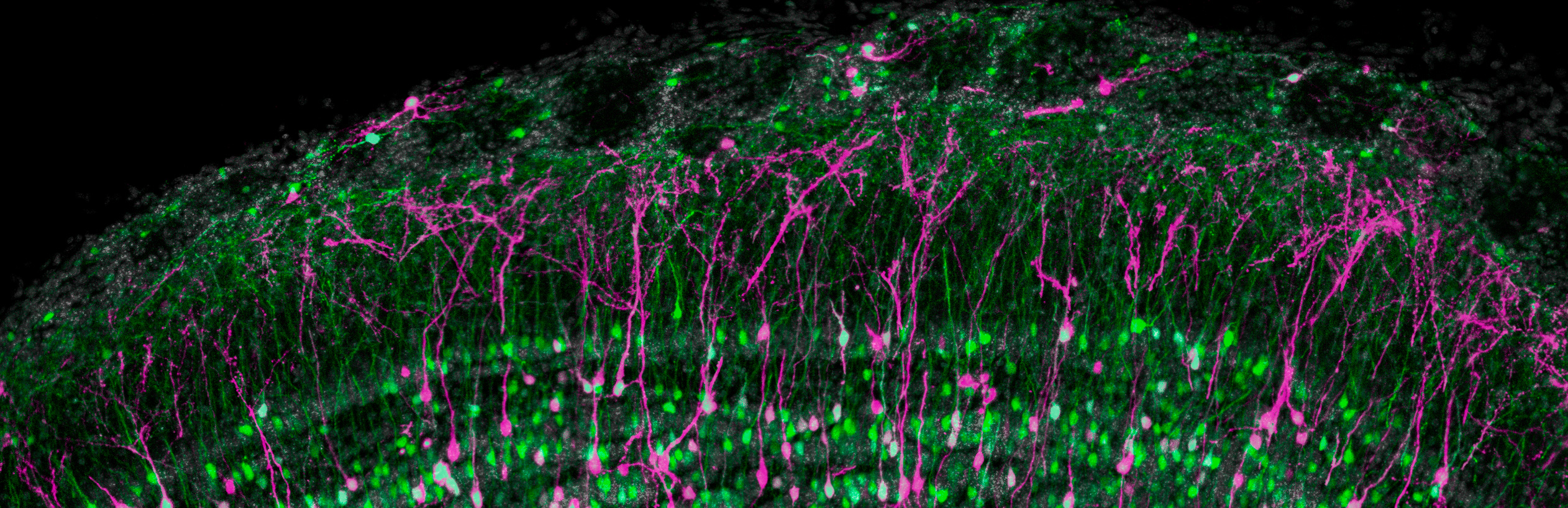 Confocal microscopy image illustrating neurogenesis in the olfactory bulb