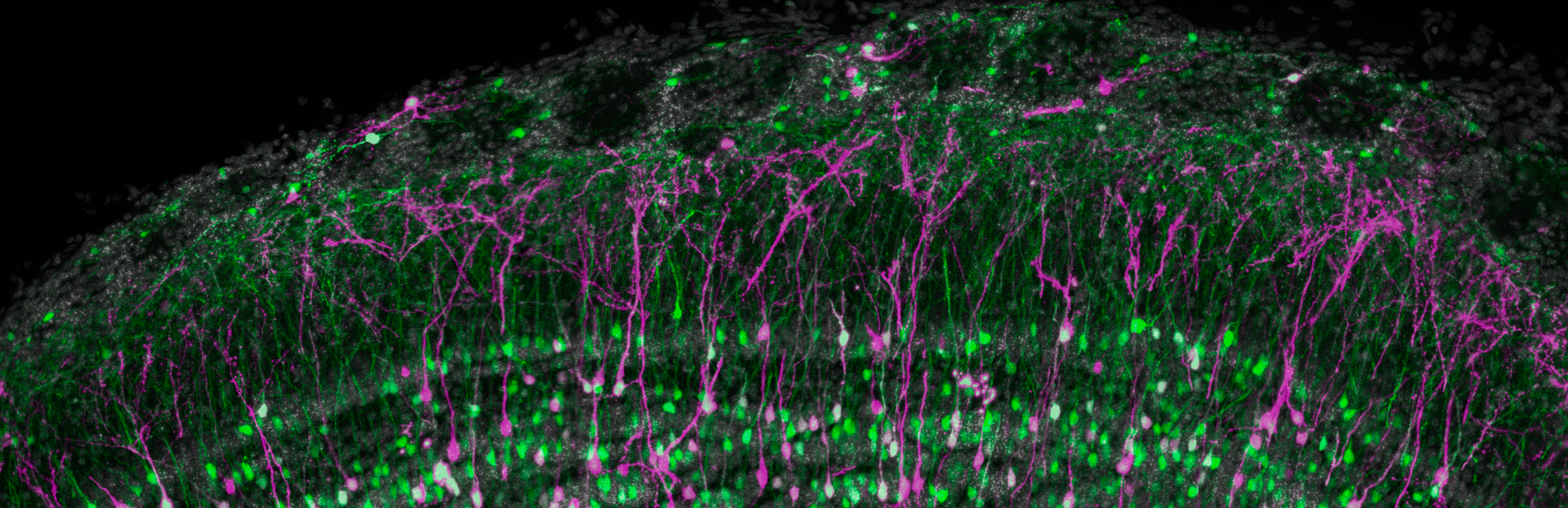 Confocal microscopy image illustrating neurogenesis in the olfactory bulb